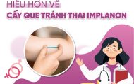 que-cay-tranh-thai-implanon